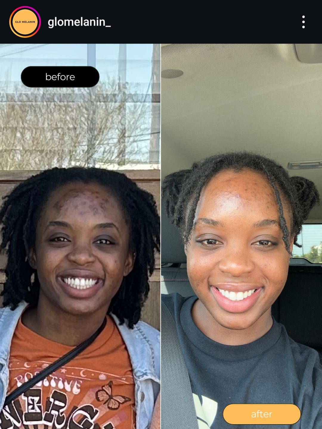 Screenshot 20240914 102417 Instagram 1